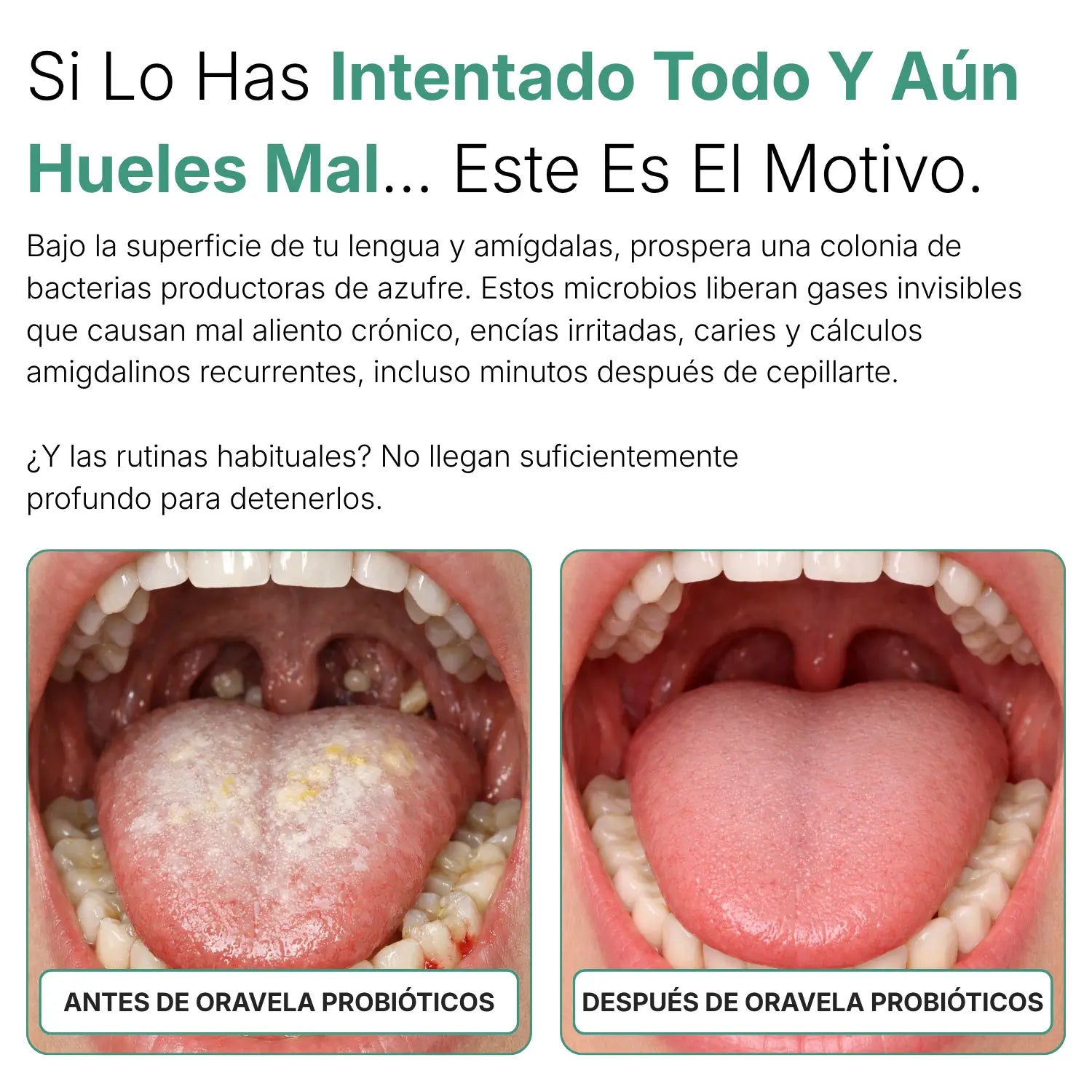 Oravela Probiótico Oral
