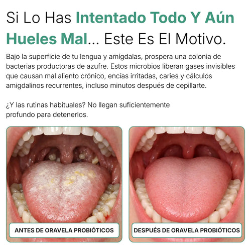 Oravela Probiótico Oral