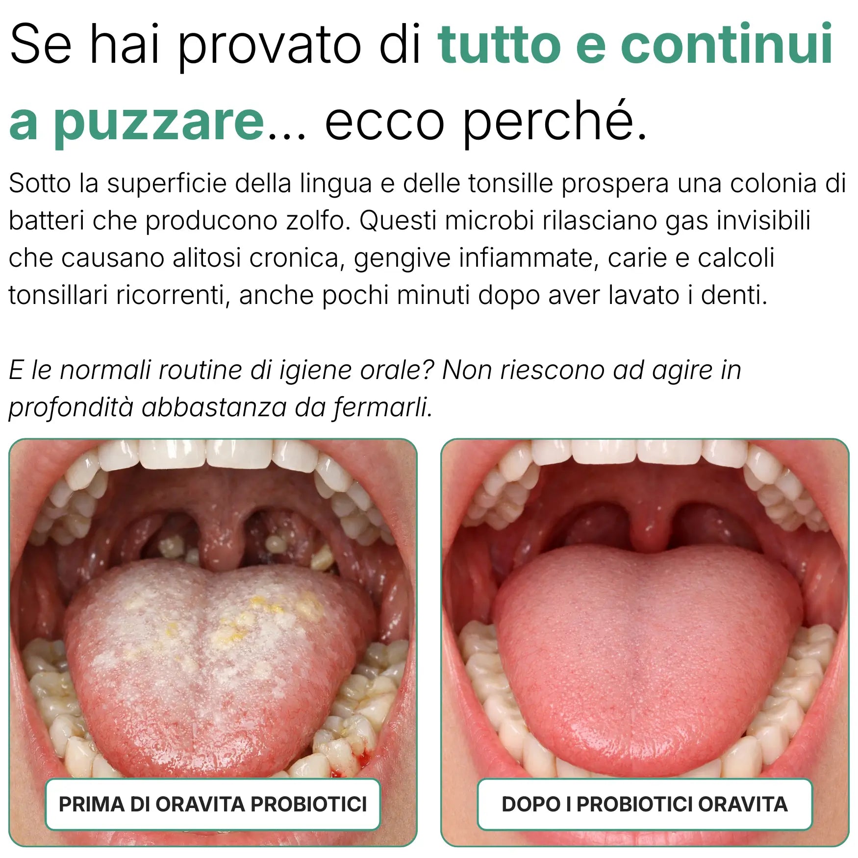 Oravela Probiótico Oral