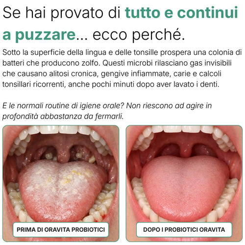 Oravela Probiótico Oral