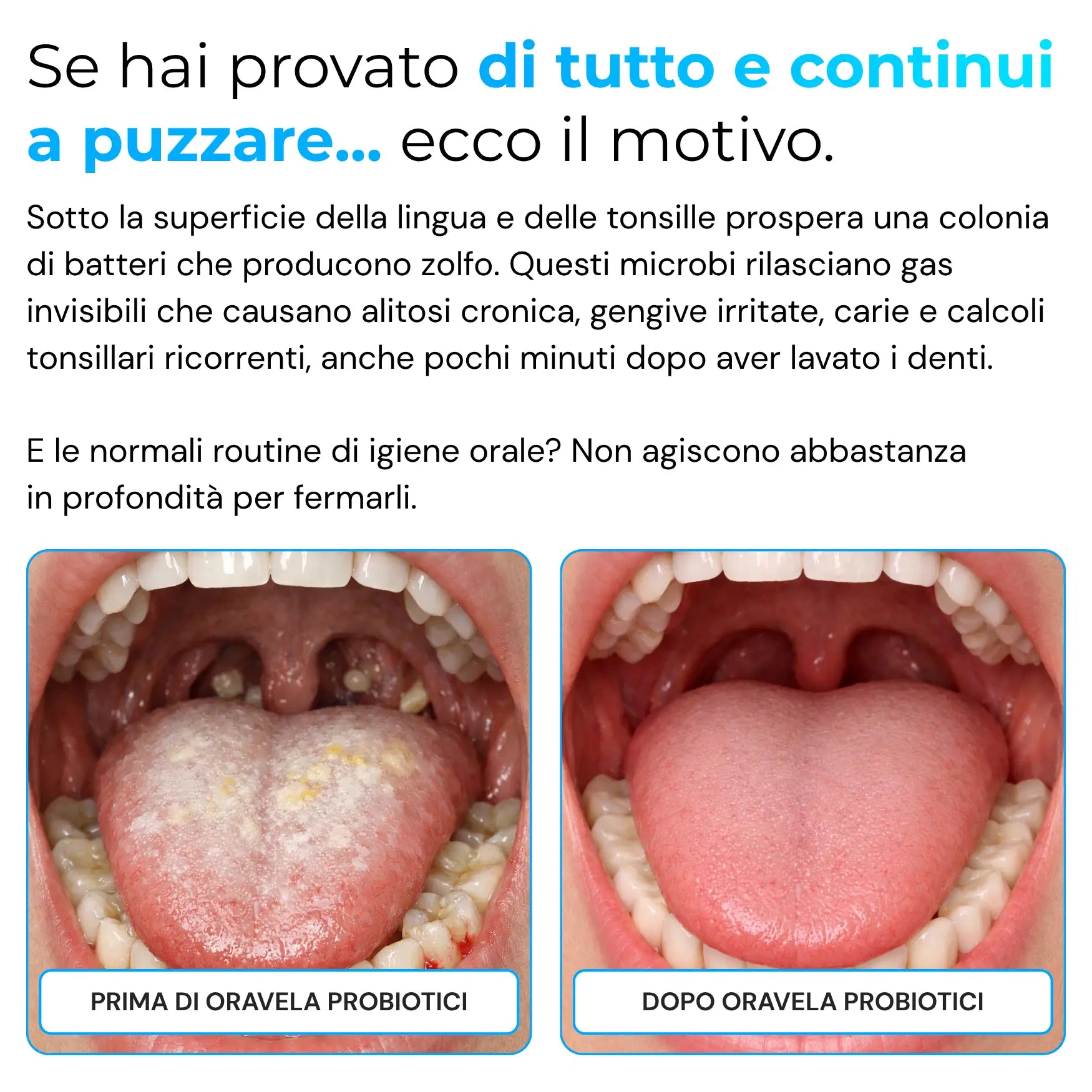 Oravela™ Probiotico Orale