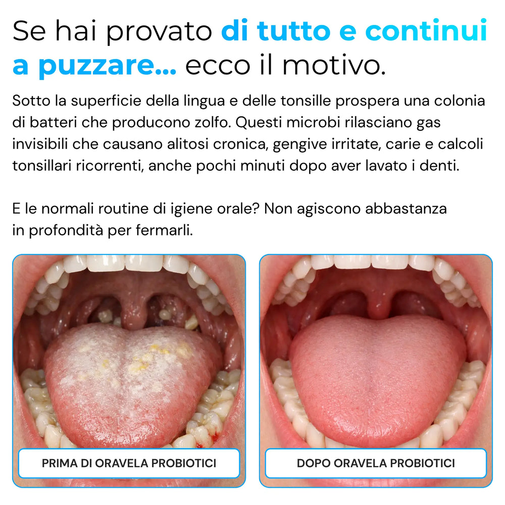 Oravela™ Probiotico Orale